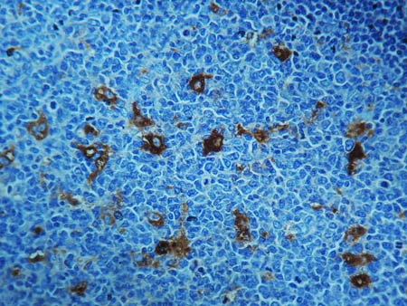 ab9373 staining alpha 1 Antitrypsin in formalin-fixed, paraffin-embedded Human tonsil tissue by Immunohistochemistry.