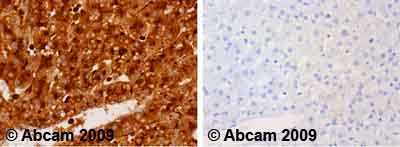 Ab49088 staining human normal liver. Staining is localised to the cytoplasm and secreted.Left panel: with primary antibody at 1 ug/ml. Right panel: isotype control.Sections were stained using an automated system DAKO Autostainer Plus , at room temperature. Sections were rehydrated and antigen retrieved with the Dako 3-in-1 antigen retrieval buffers citrate pH 6.0 in a DAKO PT Link. Slides were peroxidase blocked in 3% H2O2 in methanol for 10 minutes. They were then blocked with Dako Protein block for 10 minutes (containing casein 0.25% in PBS) then incubated with primary antibody for 20 minutes and detected with Dako Envision Flex amplification kit for 30 minutes. Colorimetric detection was completed with diaminobenzidine for 5 minutes. Slides were counterstained with Haematoxylin and coverslipped under DePeX. Please note that for manual staining we recommend to optimize the primary antibody concentration and incubation time (overnight incubation), and amplification may be r