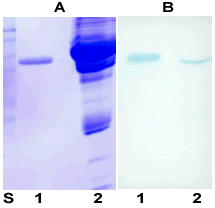 Western blot of alpha 1 antitrypsin using ab9399 at a concentration of 0.5 µg/ml. lane 2 - human plasma, 2 µl lane S - standard proteins.A - SDS-PAGE, Coomasie stainingB - Western blot with ab9399. 