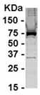 Anti-alpha 1 Catenin antibody (ab37762) at 1/2000 dilution + E. coli derived fusion protein at 2.5 µgSecondaryHRP conjugated Goat anti IgY at 1/1000 dilution