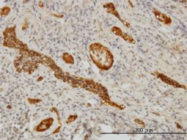 alpha 1 Fetoprotein antibody (ab54745) used in immunohistochemistry at 3ug/ml on formalin fixed and paraffin embedded human tonsil.