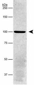 Anti-alpha 1 Sodium Potassium ATPase antibody [464.6] - Plasma Membrane Marker (ab7671) at 1/5000 dilution + Porcine proximal tubule lysate