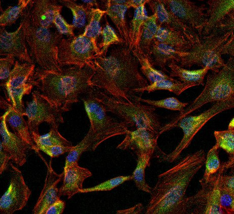 Immunocytochemistry/Immunofluorescence analysis of alpha 1 Sodium Potassium ATPase (green) in HeLa cells. Formalin-fixed cells were permeabilized with 0.1% Triton X-100 in TBS for 15 minutes at room temperature and blocked with 0.3% BSA for 15 minutes at room temperature. Cells were incubated with ab2872 (1:100) for at least 1 hour at room temperature, washed with PBS, and incubated with a DyLight 488-conjugated goat anti-mouse IgG secondary antibody (1:500) for 30 minutes at room temperature. F-actin (red) was stained with DyLight 594 Phalloidin and nuclei (blue) were stained with Hoechst 33342 dye. Images were taken at 20X magnification.