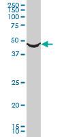 Anti-alpha 1a Adrenergic Receptor antibody (ab87990) at 1 µg/ml + HL60 at 50 µgSecondaryGoat Anti-Mouse IgG at 1/10000 dilution