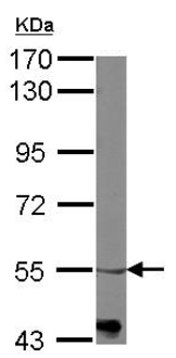 Anti-alpha 1b Adrenergic Receptor antibody (ab151507) at 1/1000 dilution + Mouse brain whole cell lysate at 50 µg