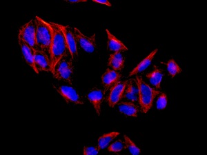 Immunofluorescent analysis of HeLa cells labeling alpha 1b Adrenergic Receptor with ab169523 at 1/250. 