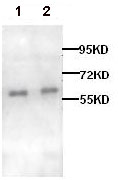All lanes : Anti-alpha 1d Adrenergic Receptor antibody (ab84402) at 1/1000 dilutionLane 1 : A549 lysateLane 2 : MCF7 lysate
