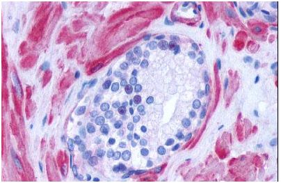 Immunohistochemical analysis of formalin-fixed, paraffin-embedded Human prostate tissue labelling alpha 1d Adrenergic Receptor with ab140690 at 3 µg/ml.
