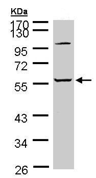 Anti-alpha 2 Glycine Receptor antibody (ab97628) at 1/5000 dilution + A431 whole cell lysate at 30 µg