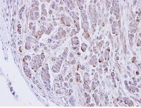 ab97628, at a 1/500 dilution, staining alpha 2 Glycine Receptor in paraffin embedded MDAMB468 xenograft by Immunohistochemistry.