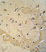 ab107292, at 1/50 dilution, staining alpha 2 Glycine Receptor in formalin-fixed, paraffin-embedded Human brain tissue by Immunohistochemistry using a peroxidase conjugated secondary antibody and DAB staining.