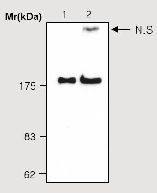 All lanes : Anti-alpha 2 Macroglobulin antibody [2D9] (ab36995)Lane 1 : Alpha 2 Macroglobulin isolated from Human plasmaLane 2 : Human plasmaLysates/proteins at 50 µg per lane.Secondaryanti-mouse IgG -HRP