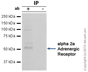 alpha 2a Adrenergic Receptor was immunoprecipitated using 0.5mg Mouse Pancreas tissue lysate, 5µg of Rabbit polyclonal to alpha 2a Adrenergic Receptor and 50µl of protein G magnetic beads (+). No antibody was added to the control (-). The antibody was incubated under agitation with Protein G beads for 10min, Mouse Pancreas tissue lysate lysate diluted in RIPA buffer was added to each sample and incubated for a further 10min under agitation.Proteins were eluted by addition of 40µl SDS loading buffer and incubated for 10min at 70oC; 10µl of each sample was separated on a SDS PAGE gel, transferred to a nitrocellulose membrane, blocked with 5% BSA and probed with ab65833.Secondary: Mouse monoclonal [SB62a] Secondary Antibody to Rabbit IgG light chain (HRP) (ab99697).Band: 52kDa; non specific band - 100kDa: We are unsure as to the identity of this extra band; alpha 2a Adrenergic Receptor.