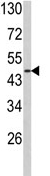Anti-alpha 2b Adrenergic Receptor antibody (ab91468) at 1/100 dilution + MDA-MB231 cell line lysate at 35 µg