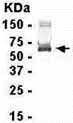 Anti-alpha 2b Adrenergic Receptor antibody (ab49689) at 1/2000 dilution + E coli-derived fusion protein at 15 µgSecondaryGoat anti-IgY-HRP at 1000
