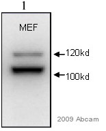 Anti-alpha Actinin 4 antibody (ab59468) at 1/1000 dilution + Whole cell lysates prepared from mouse embryonic fibroblasts at 10 µgSecondaryHRP conjugated goat polyclonal to rabbit IgG at 1/3000 dilutionPerformed under reducing conditions.
