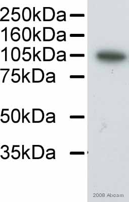 Anti-alpha Actinin antibody [0.T.02] (ab18061) at 1/2000 dilution + Human pancreatic cancer cell line - whole cell lysate at 20 µgSecondaryHRP conjugated goat anti-mouse antibody at 1/2000 dilutiondeveloped using the ECL techniquePerformed under reducing conditions.
