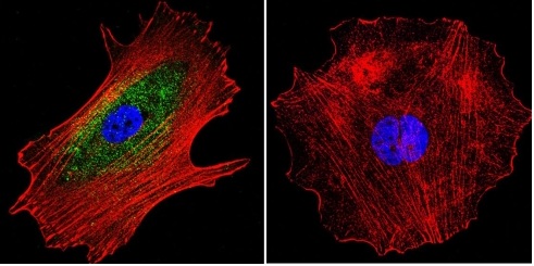 Immunofluorescent analysis of alpha Adaptin using alpha Adaptin Monoclonal Antibody (AP6) (ab2720) shows staining in MCF-7 Cells. alpha Adaptin (green) F-Actin staining with Phalloidin (red) and nuclei with DAPI (blue) is shown. Cells were grown on chamber slides and fixed with formaldehyde prior to staining. Cells were probed without (control) or with an antibody recognizing alpha Adaptin (ab2730) at a dilution of 1:20 over night at 4 C and incubated with a DyLight-488 conjugated secondary antibody. Images were taken at 60X magnification.