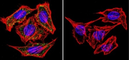 Immunofluorescent analysis of alpha Adaptin using alpha Adaptin Monoclonal Antibody (AP6) (ab2730) shows staining in Hela Cells. alpha Adaptin (green) F-Actin staining with Phalloidin (red) and nuclei with DAPI (blue) is shown. Cells were grown on chamber slides and fixed with formaldehyde prior to staining. Cells were probed without (control) or with an antibody recognizing alpha Adaptin (ab2720) at a dilution of 1:20 over night at 4 C and incubated with a DyLight-488 conjugated secondary antibody. Images were taken at 60X magnification.