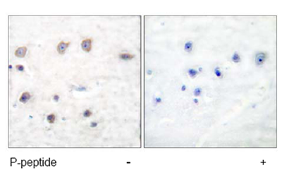 labelled with ab53093, at 1/50 dilution, staining alpha Adducin in paraffin embedded human brain tissue sections by Immunohistochemistry. Tissues had either been treated with (right image) or without (left image) the phosphopeptide.
