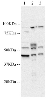 All lanes : Anti-5HT1A Receptor antibody (ab64994) at 1 µg/mlLane 1 : Brain (Human) Tissue Lysate - adult normal tissue (ab29466)Lane 2 : Brain (Mouse) Tissue Lysate (ab27253)Lane 3 : Brain (Rat) Tissue Lysate (ab7942)