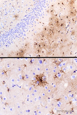 ab85937 staining 5HT1B Receptor on Marmoset Hippocampus (upper) and Cortex (lower). The tissue were fixed in formaldehyde and subjeted to heated mediated antigen retrieval uisng citric acid (pH 6). the tissue was blocked by incubating in 1% BSA for 10 mins at 21°C. The antibody was diluted 1/500 using TBS/BSA/Azide. The antibody was incubated for 2 hours at 21°C. See Abreview