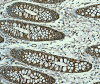 Immunohistochemical analysis of Paraffin Embedded Human colon tissue labelling Alpha Fodrin with ab133320 at 1/500 dilution.