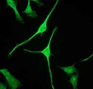 Immunofluorescent analysis of HeLa cells labelling Alpha Fodrin with ab133320 at 1/250 dilution.