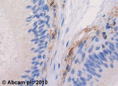 ab2607 (4µg/ml) staining 5HT1B in human testis using an automated system (DAKO Autostainer Plus). Using this protocol there is strong staining of membrane compartment of the mature seminiferous tubules and possible interstitial cells.Sections were rehydrated and antigen retrieved with the Dako 3 in 1 AR buffer EDTA pH 9.0 in a DAKO PT link. Slides were peroxidase blocked in 3% H2O2 in methanol for 10 mins. They were then blocked with Dako Protein block for 10 minutes (containing casein 0.25% in PBS) then incubated with primary antibody for 20 min and detected with Dako envision flex amplification kit for 30 minutes. Colorimetric detection was completed with Diaminobenzidine for 5 minutes. Slides were counterstained with Haematoxylin and coverslipped under DePeX. Please note that, for manual staining, optimization of primary antibody concentration and incubation time is recommended. Signal amplification may be required.