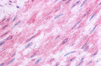 Immunohistochemical analysis of formalin fixed, paraffin embedded Human vascular smooth muscle tissue labelling 5HT1B Receptor with ab140531 at 7 µg/ml.