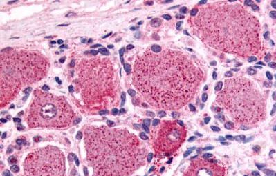 Immunohistochemical analysis of formalin fixed, paraffin embedded Human spinal cord, dorsal root ganglion tissue labelling 5HT1D Receptor with ab140486 at 17 µg/ml.