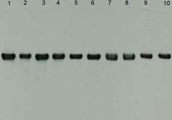 All lanes : Anti-alpha Internexin antibody [2E3] (ab7654)Lane 1 : Crude homogenate of rat facial nucleus at 3 days after experimental injuryLane 2 : Crude homogenate of rat facial nucleus at 3 days after experimental injuryLane 3 : Crude homogenate of rat facial nucleus at 5 days after experimental injuryLane 4 : Crude homogenate of rat facial nucleus at 5 days after experimental injuryLane 5 : Crude homogenate of rat facial nucleus at 7 days after experimental injuryLane 6 : Crude homogenate of rat facial nucleus at 7 days after experimental injuryLane 7 : Crude homogenate of rat facial nucleus at 14 days after experimental injuryLane 8 : Crude homogenate of rat facial nucleus at 14 days after experimental injuryLane 9 : Crude homogenate of rat facial nucleus at 28 days after experimental injuryLane 10 : Crude homogenate of rat facial nucleus at 28 days after experimental injury