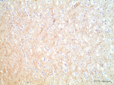 ab7654 staining alpha Internexin in human cerebral cortex tissue sections by Immunohistochemistry (IHC-P - paraformaldehyde-fixed, paraffin-embedded sections). Tissue was fixed with formaldehyde and blocked with 3% hydrogen peroxide for 10 minutes at 25°C; antigen retrieval was by heat mediation in EDTA, pH 9.0 (100°C for 20 minutes). Samples were incubated with primary antibody (1/2500) for 20 minutes at 25°C.See Abreview