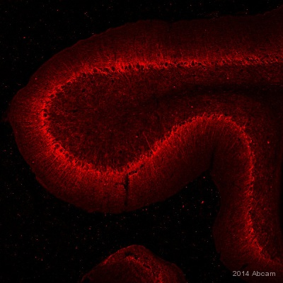 ab40758 staining alpha Internexin in rat brain tissue sections by Immunohistochemistry (PFA perfusion fixed frozen sections). Tissue samples were fixed by perfusion with formaldehyde, permeablized with 0.01% Triton X-100, blocked with 5% serum for 2 hours at 4°C and antigen retrieval was by heat mediation in citrate buffer. The sample was incubated with primary antibody (1/250) at 4°C for 10 hours. An undiluted Alexa Fluor® 555-conjugated anti-rabbit IgG polyclonal was used as the secondary antibody.See Abreview