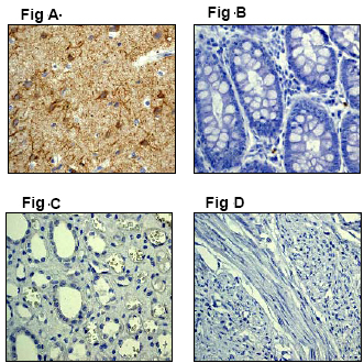 Positive staining of alpha Internexin on paraffin-embedded human brain tissue (A) using ab40758 diluited 1:250. Negative staining of paraffin-embedded human colon (B), Kidney (C) and uterus (D) tissues using ab40758 under the same conditions.
