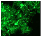 Immunofluorescent staining of alpha Internexin on PC 12 cells using ab40758 diluted 1:250.