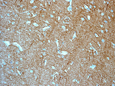 ab108302, at 1/250, staining alpha Internexin in human brain tissue by immunohistochemistry