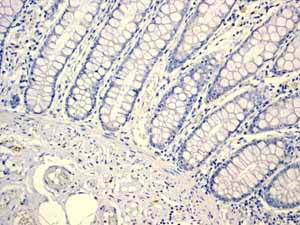 ab108302 showing negative staining in Normal colon tissue.