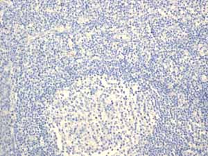 ab108302 showing negative staining in Normal tonsil tissue.