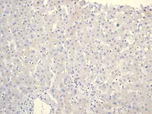 ab108302 showing negative staining in Normal liver tissue.