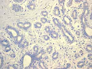 ab108302 showing negative staining in Normal breast tissue.