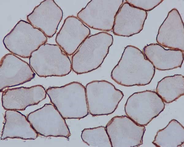 Immunhistochemical analysis of paraffin-embedded Human skeletal muscle tissue labeling alpha Sarcoglycan with ab189254 at 1/2000 dilution, followed by prediluted HRP Polymer for Rabbit IgG. Counter stained with Hematoxylin.
