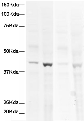 All lanes : Anti-alpha smooth muscle Actin antibody (ab15734) at 1 µg/mlLane 1 : HeLa whole cell lysateLane 2 : A431 cell lysateLane 3 : HeLa whole cell lysate with Human alpha smooth muscle Actin peptide (ab16102) at 1 µg/mlLane 4 : A431 cell lysate with Human alpha smooth muscle Actin peptide (ab16102) at 1 µg/mlLysates/proteins at 20 µg per lane.SecondaryGoat-anti-Rabbit IgG at 1/10000 dilutionPerformed under reducing conditions.