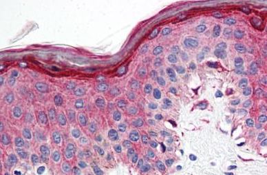 Immunohistochemical analysis of formalin-fixed, paraffin-embedded Human skin tissue labelling 5HT1E Receptor with ab140506 at 10 µg/ml.