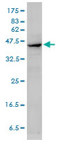 Anti-alpha smooth muscle Actin antibody (ab54723) at 1 µg/ml + Whole tissue lysate prepared from human omentum, serous carcinoma.