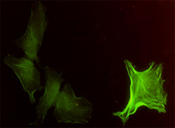 ab54723 at 1 - 10 ug/ml staining Alpha smooth muscle actin in human Hela cells by Immunocytochemistry / Immunofluorescence.