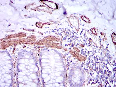 Immunohistochemical analysis of paraffin-embedded Human duodenum tissue using ab119952 at a dilution of 1/200 with DAB staining.