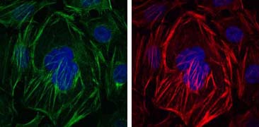 Immunofluorescence analysis of HepG2 cells using ab119952 at 1/200 (green). Actin filaments have been labeled with Alexa Fluor-555 phalloidin (Red). DRAQ5 fluorescent DNA dye (blue).
