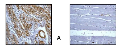 Immunohistochemical analysis of paraffin-embedded (A) human uterus tissue, showing positive staining of smooth muscle, and (B) skeletal muscle tissue, showing negative staining of skeletal muscle, using anti-alpha Actin (Smooth Muscle) (ab32572) diluted 1:500Immunohistochemical analysis of paraffin-embedded (A) human uterus tissue, showing positive staining of smooth muscle, and (B) skeletal muscle tissue, showing negative staining of skeletal muscle, using anti-alpha Actin (Smooth Muscle) (ab32572) diluted 1:500