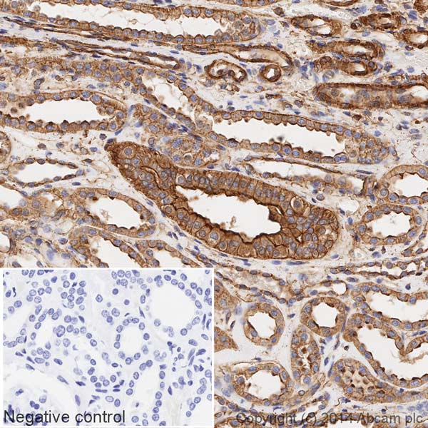 IHC image of alpha smooth muscle Actin staining in a section of formalin-fixed paraffin-embedded normal human kidney tissue*, performed on a Leica BOND. The section was pre-treated using heat mediated antigen retrieval with sodium citrate buffer (pH6, epitope retrieval solution 1) for 20mins. The section was then incubated with ab196920 at 1/100 dilution, for 15 mins at room temperature. DAB was used as the chromogen. The section was then counterstained with haematoxylin and mounted with DPX. The inset negative control image is taken from an identical assay without primary antibody.For other IHC staining systems (automated and non-automated) customers should optimize variable parameters such as antigen retrieval conditions, primary antibody concentration and antibody incubation times.*Tissue obtained from the Human Research Tissue Bank, supported by the NIHR Cambridge Biomedical Research Centre